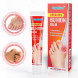 Крем от шишек на ногах (Sumifun Bunion Balm) 20 г