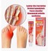 Крем от шишек на ногах (Sumifun Bunion Balm) 20 г