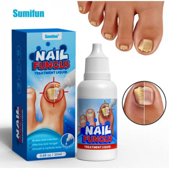 УЦЕНКА! Противогрибковое средство для ногтей жидкость СРОК ДО 03.2026 (Nail Fungus Treatment liquid Sumifun) 20 мл