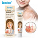 Крем Витилиго (Vitiligo cream Sumifun) 20 г