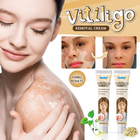 Крем Витилиго (Vitiligo cream Sumifun) 20 г