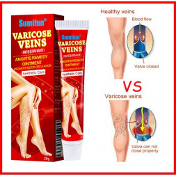 УЦЕНКА! Крем от варикоза ПОМЯТА УПАКОВКА (Varicose Veins Angitis Remedy Ointment Sumifun) 20 г