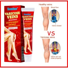 УЦЕНКА! Крем от варикоза СРОК ДО 10.2026 (Varicose Veins Angitis Remedy Ointment Sumifun) 20 г